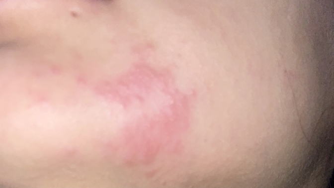 Can someone tell me what can this be a rash? Eczema? (pic)?