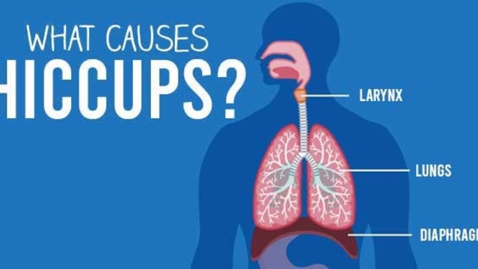 I have hiccups right now. What do I do to stop them?