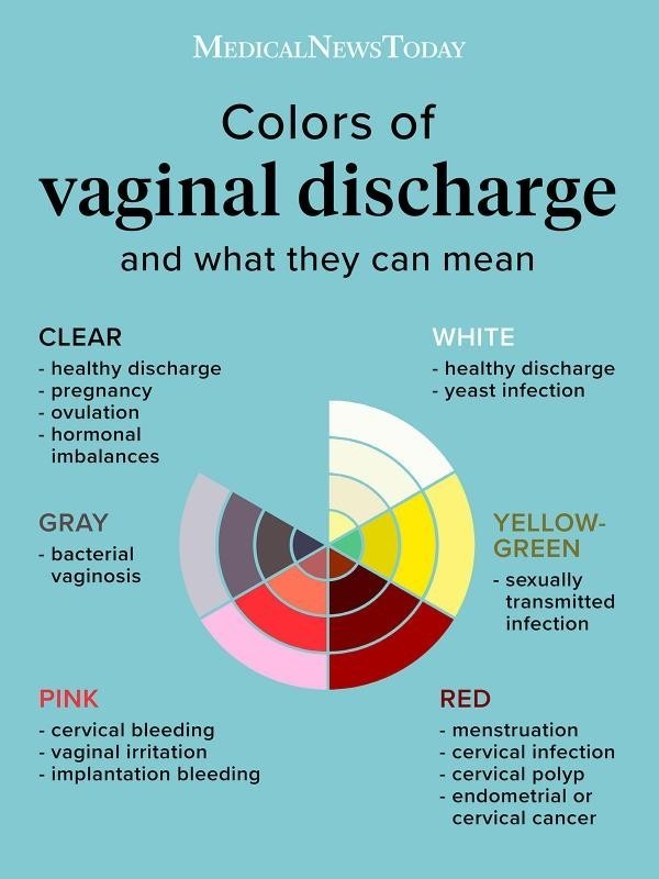 Girls do you ever get yellow stains on underwear?
