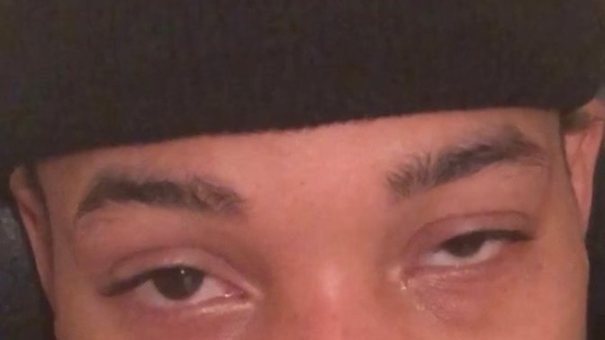 Is a lazy eye a deal breaker asking cause some people say they notice some people don’t but I think it makes me look slow?