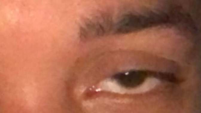 Mad insecure bout my lazy eye?