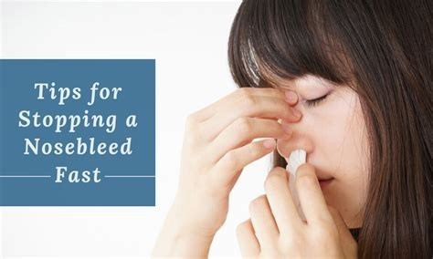 How often do you get a nosebleed?