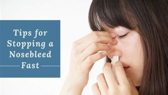How often do you get a nosebleed?