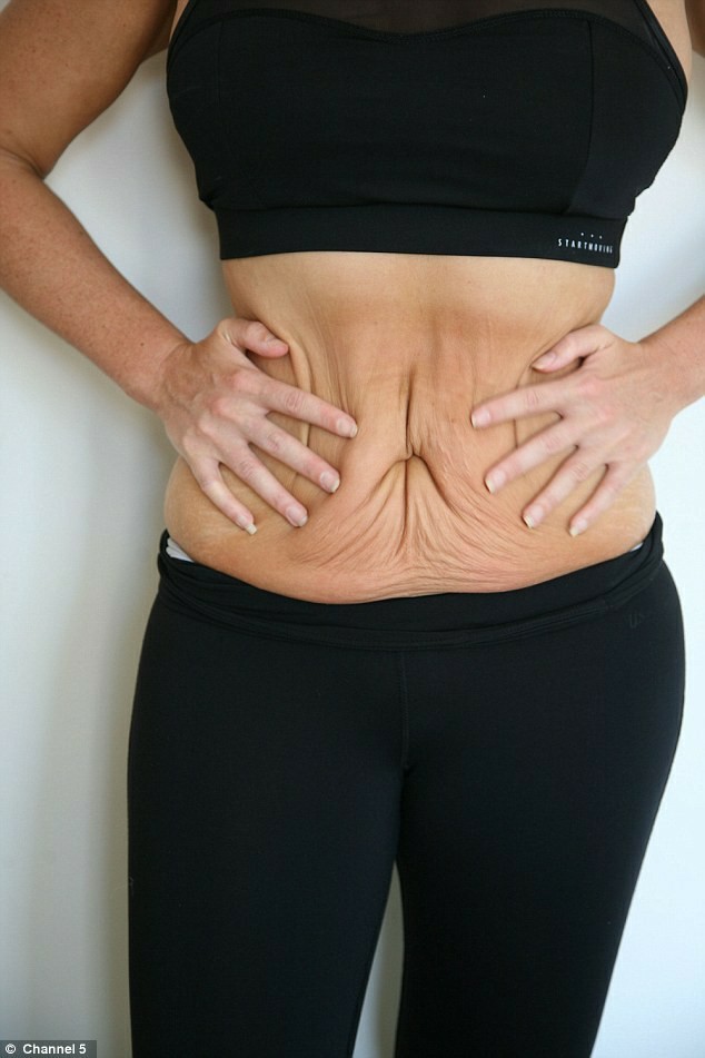 Guys, would you be ok if your wife/girlfriend gets loose saggy skin from pregnancy? Can you avoid getting saggy loose skin?