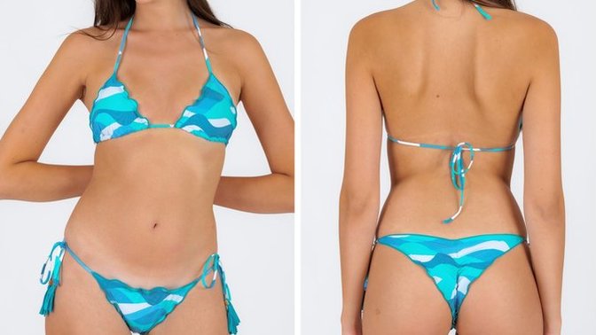 Which pattern do you like the most?