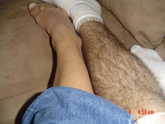 Too much difference between his skin and her skin?