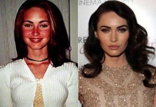 How did you look as a teenager compared to how you look now? Do you look better or worse?