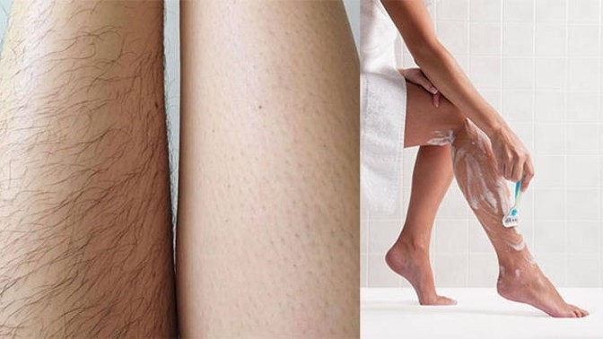 Hairy women... Hit or miss?