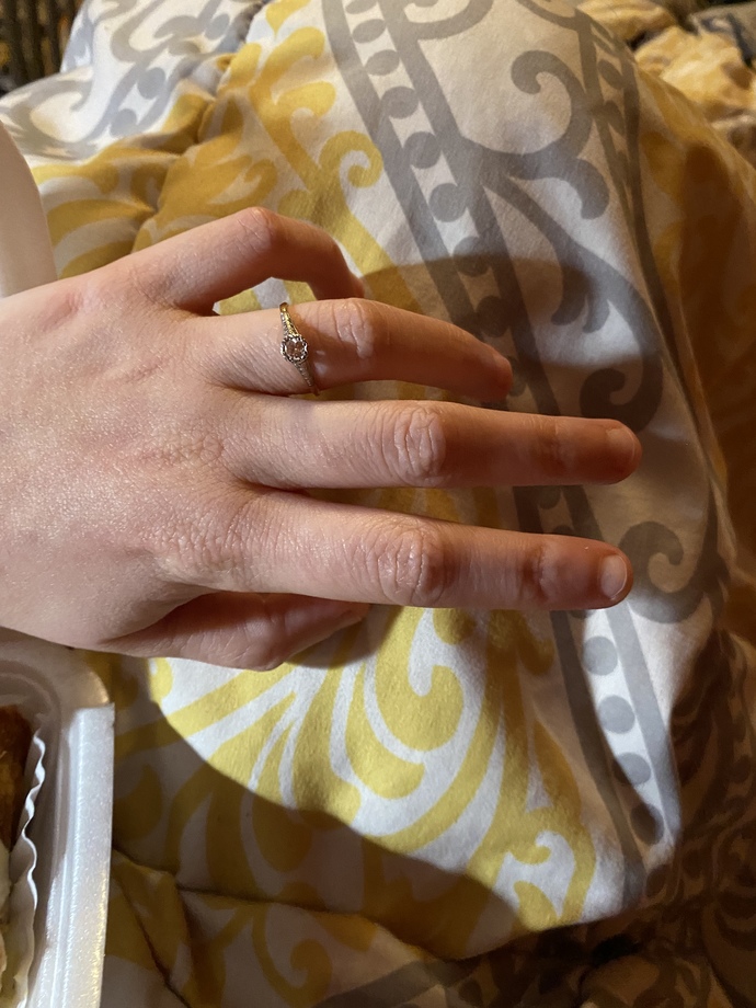 Does my hand match my engagement ring?