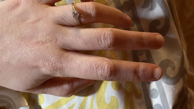 Does my hand match my engagement ring?