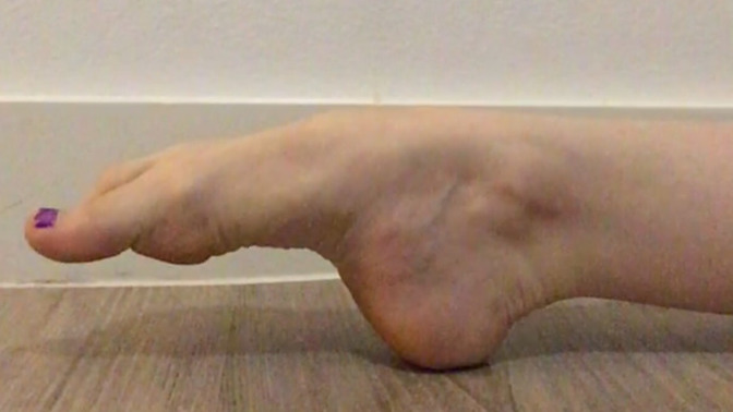 How can I improve my arch for dance (want to do floor point)?