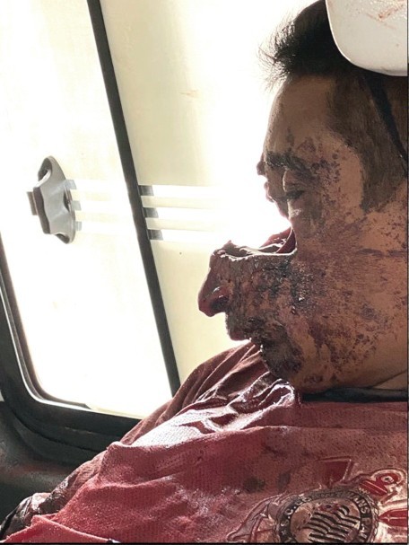 What would you do if someone hit your child?