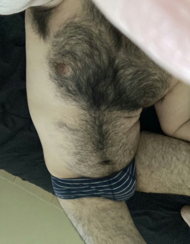 Girls, Can you still like a guy knowing he is overly hairy bodied?