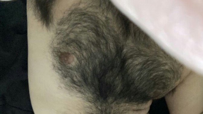 Girls, Can you still like a guy knowing he is overly hairy bodied?