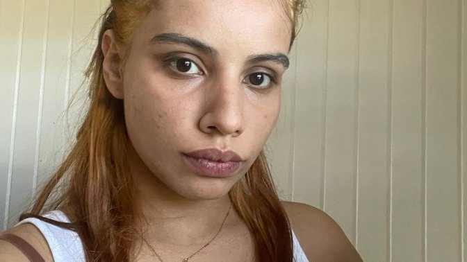 If I want to go blonde and I bleached my hair from natural dark brown?