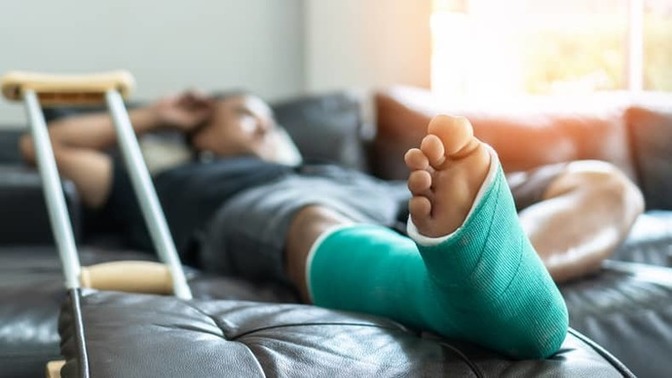 Have you ever broken a bone?