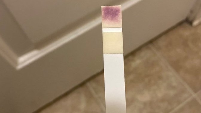 Girls, Positive UTI?