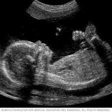 Abortion...Is it wrong?