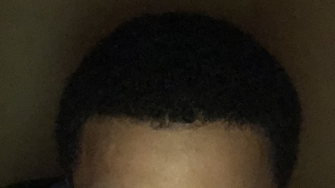 You think it’s worth the surgery @20?