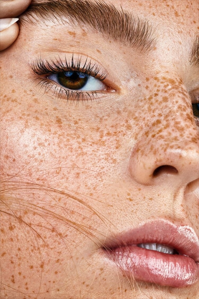What are your thoughts on freckles, and are they attractive?