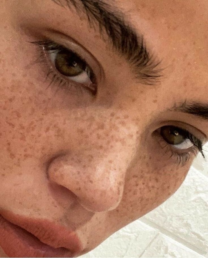 What are your thoughts on freckles, and are they attractive?