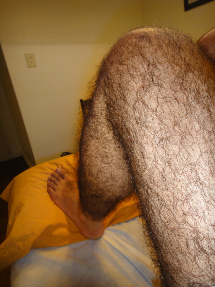 Really hairy arms and legs?