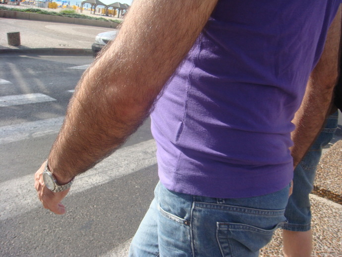 Really hairy arms and legs?
