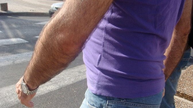 Really hairy arms and legs?