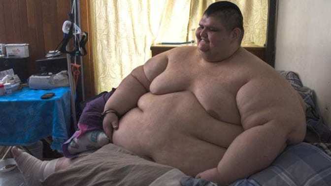 Do you think that fatness (especially obese) is a form of laziness?