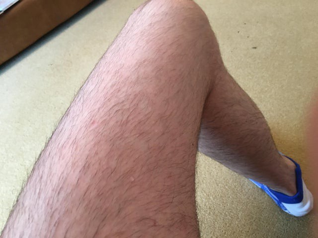 Shaved the legs and this is how it looks now?
