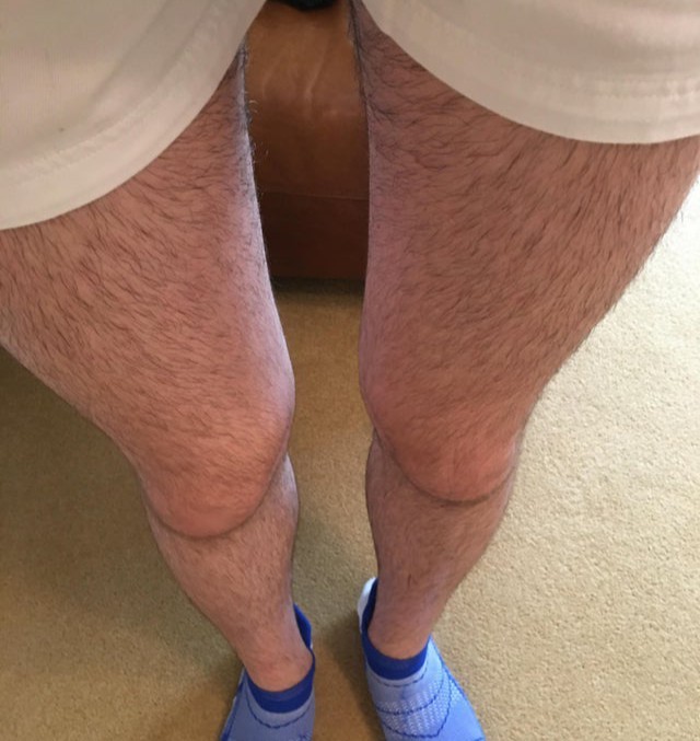 Shaved the legs and this is how it looks now?