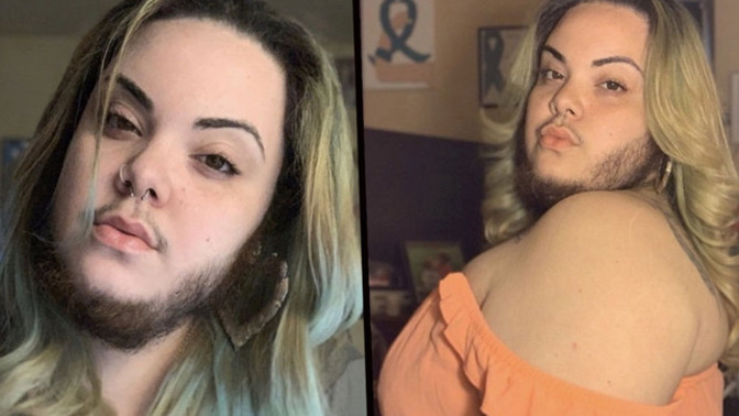 What are your thoughts about a woman having facial hair?