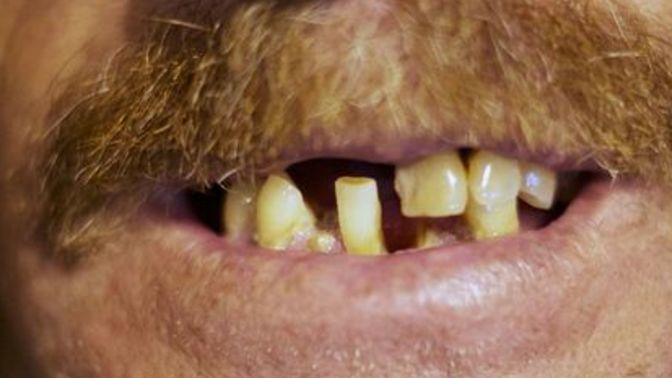 Would you date someone with messed up teeth?