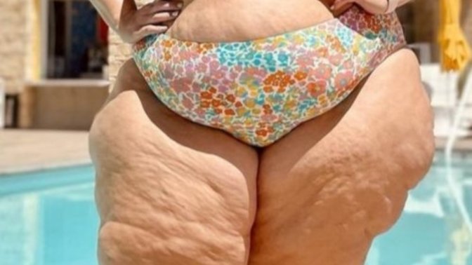 Do we personally find obesity unattractive or is it the society that shapes that negative view on obesity in us?