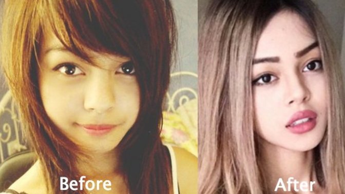 Why won’t my boyfriend let me get plastic surgery even though he checks out other girls?