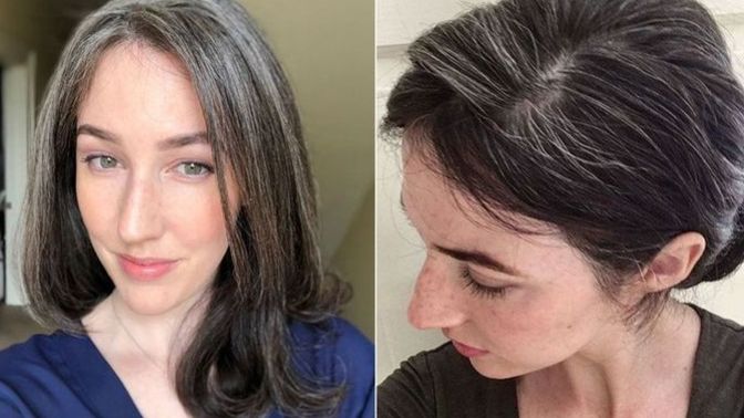 Is it turn off when a girl has some grey hair in her 20s? What can you do against premature grey hair?
