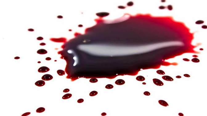 How do you feel about blood? Are you ok with it, or does the sight of it make you feel sick and queasy?