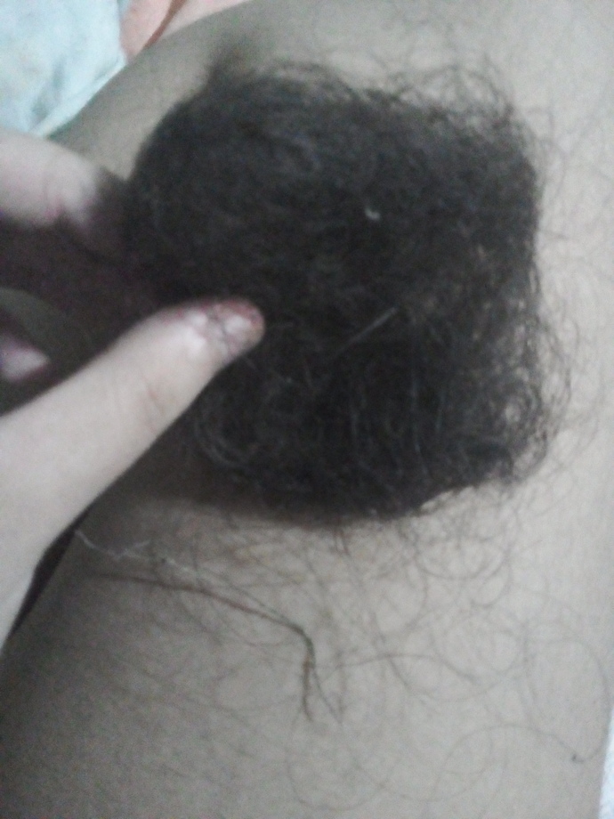 How do I stop my hair from falling out so much?