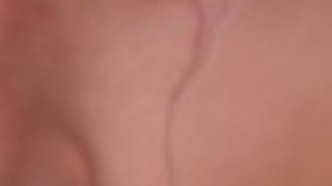 Girls, Would you find it attractive if a guy had this scar?