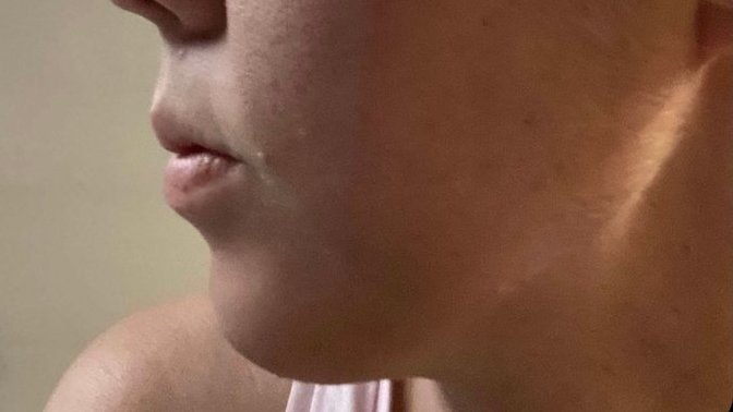 Do you think I have a receding chin?