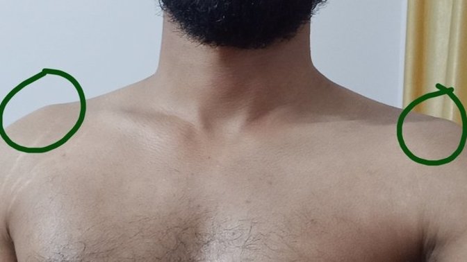 How to get rid of this bone?