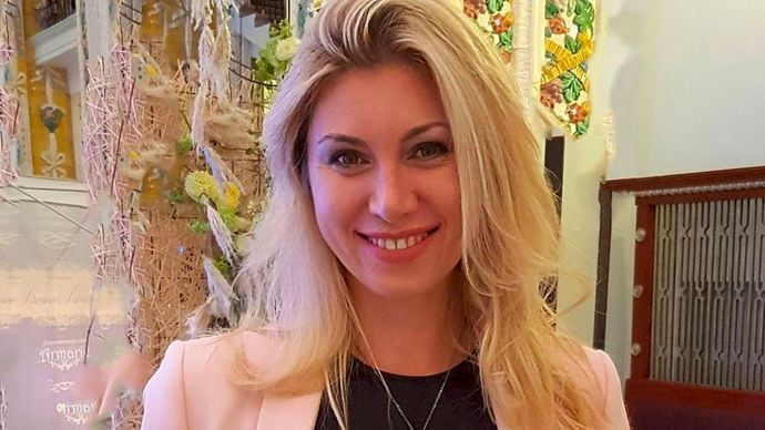 Woman looks like a Zombie after plastic surgery?