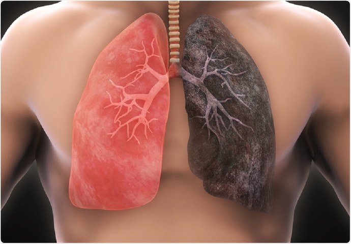 Which one is worse for you smoking or drinking?