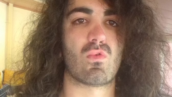 Girls, İ have cleft lip. What do you think? is it Too bad for kissing?