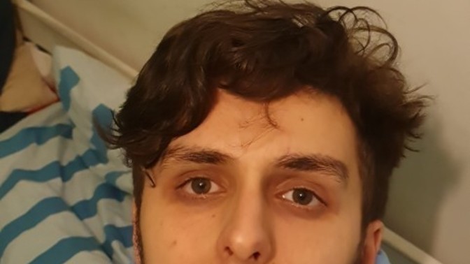 Can anyone give game changing advice to remove these dark circles?