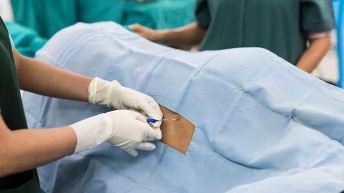 Ever had a spinal tap, lumbar puncture, epidural, or bone marrow procedure? What was your experience?