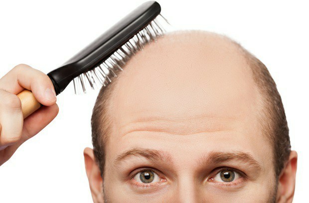 Guys: Are you afraid of losing all of your hair?