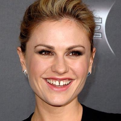 Do You Have Gaps In Your Teeth? Also Do You Find Teeth Gaps Attractive?