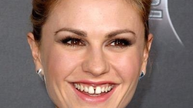 Do You Have Gaps In Your Teeth? Also Do You Find Teeth Gaps Attractive?