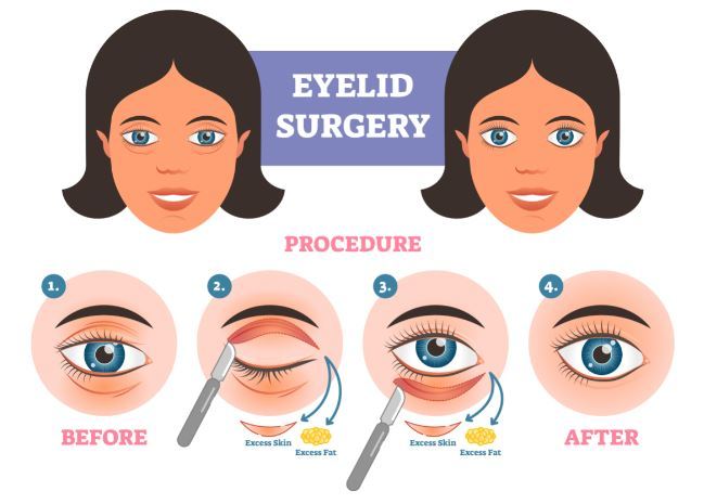 How can I make my eyes look almond rather than round?